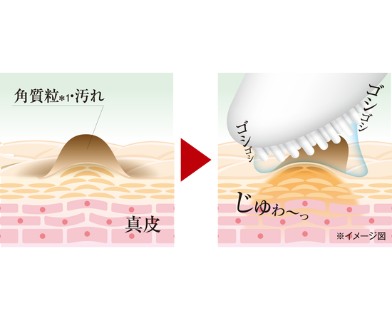 Средство против папиллом TSUBUPORON PEELING GEL Liberta